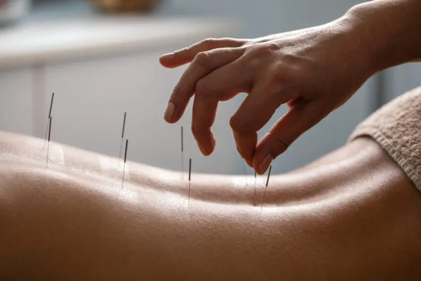 sherrell acupuncture