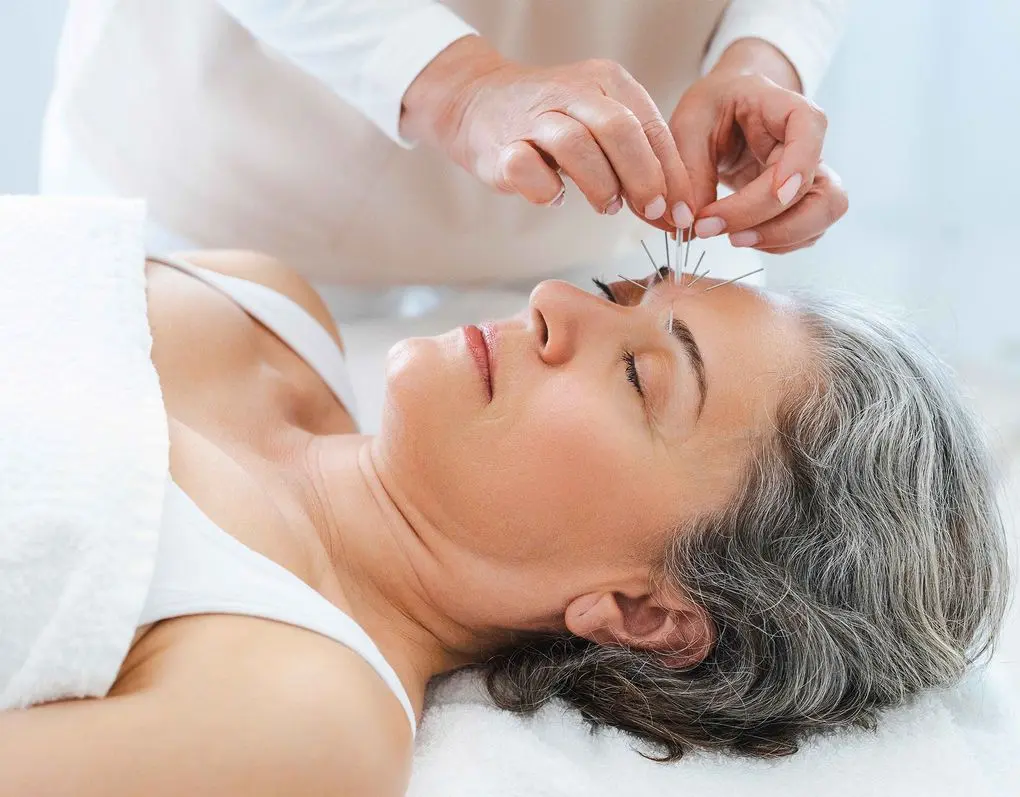 sherrell acupuncture