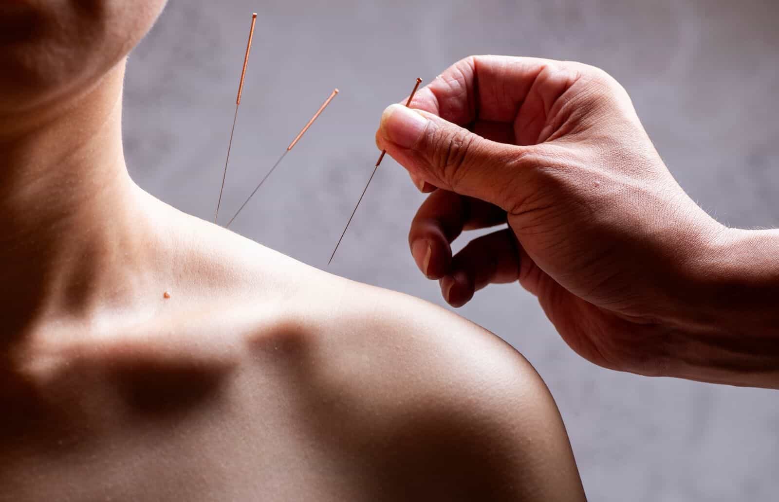 Augusta Acupuncture Clinic | Top Shoulder Pain Doctor in Augusta