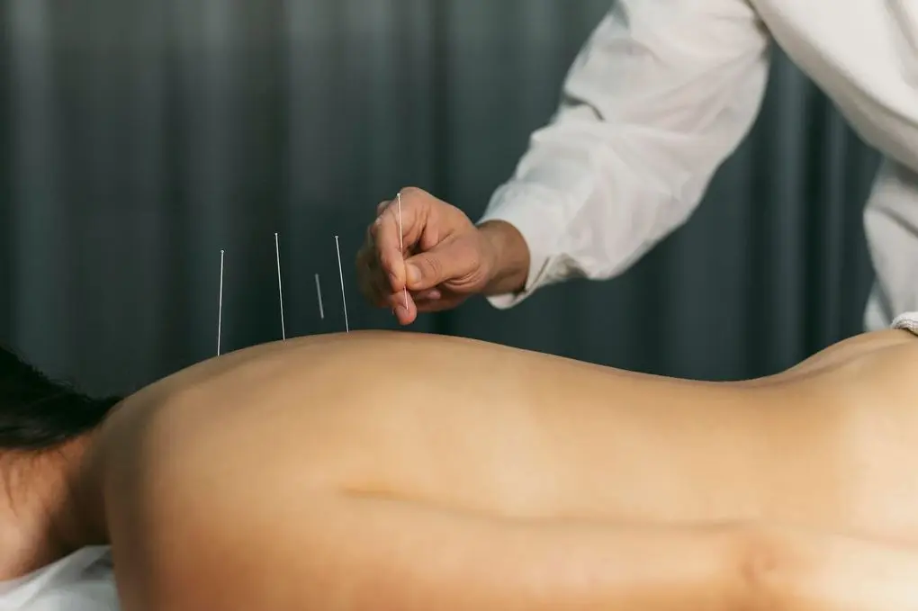 acupuncture-process Augusta Acupuncture Clinic | Autoimmune Disorders