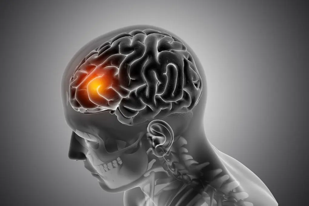 male-medical-figure-with-front-brain-highlighted Augusta Acupuncture Clinic | Top TBI Acupuncture Specialist in Augusta