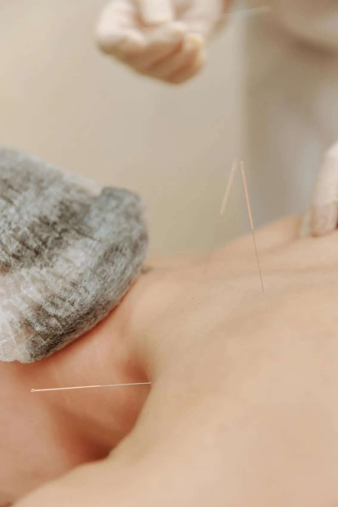 pexels-thirdman-6193366 Augusta Acupuncture Clinic | Augusta’s Acupuncture Clinic for Fatigue