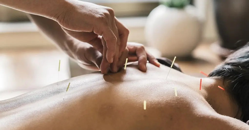 sherrell acupuncture