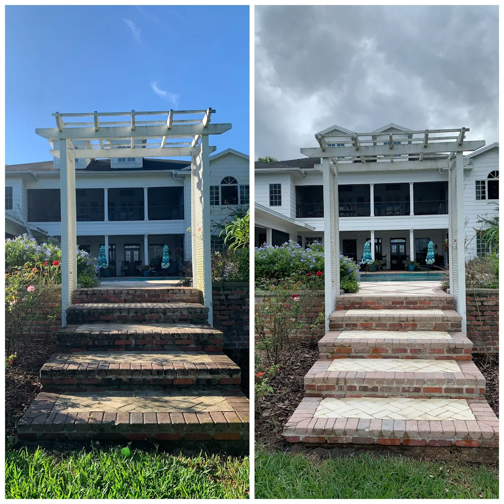 Gum Removal in Longwood FL