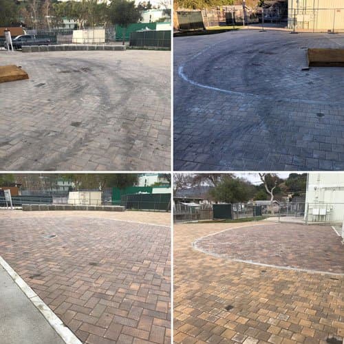 Gum Removal Los Angeles