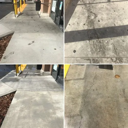 Gum Removal Los Angeles