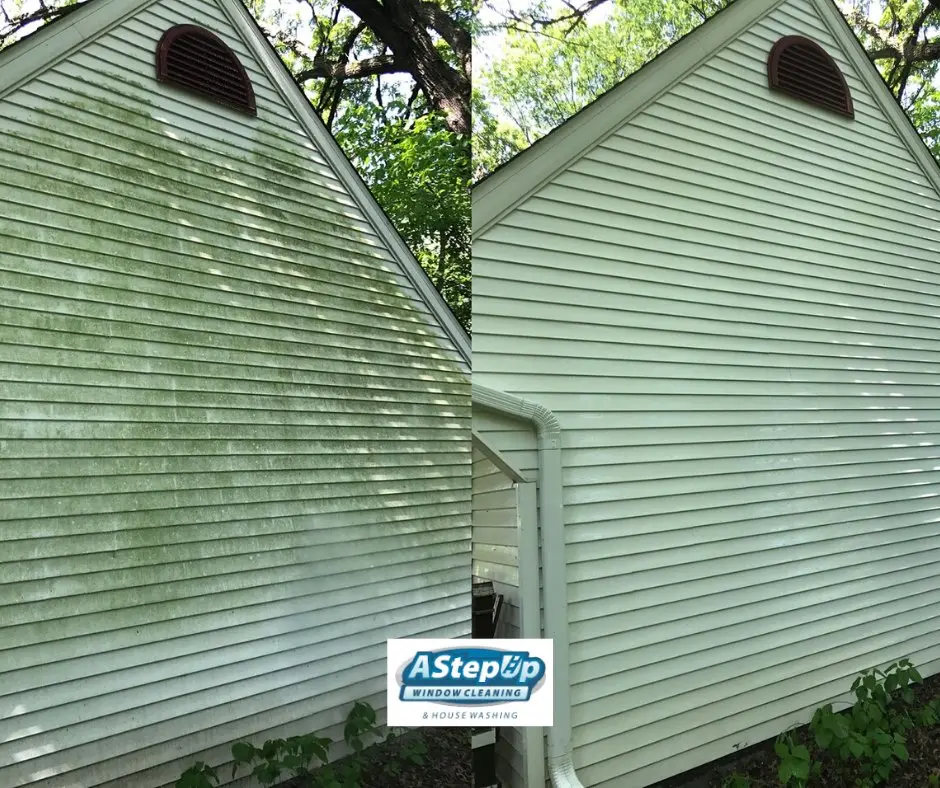 Gum Removal Minneapolis