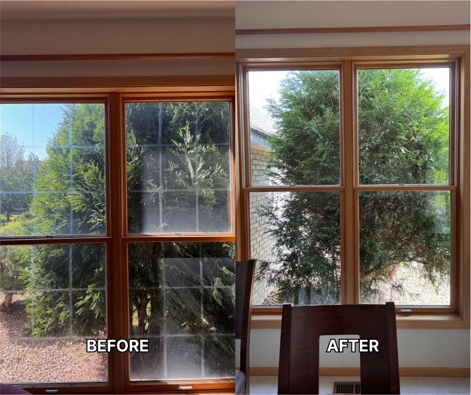 Gum Removal Minneapolis