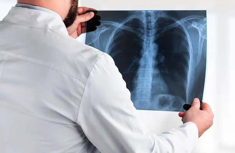 Chiropractor examining X-ray of spine for back pain treatment at McCracken Chiropractic.
