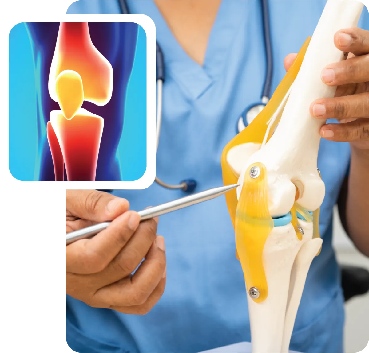 Medical professional in blue scrubs pointing a tool at an anatomical model of a human knee joint.