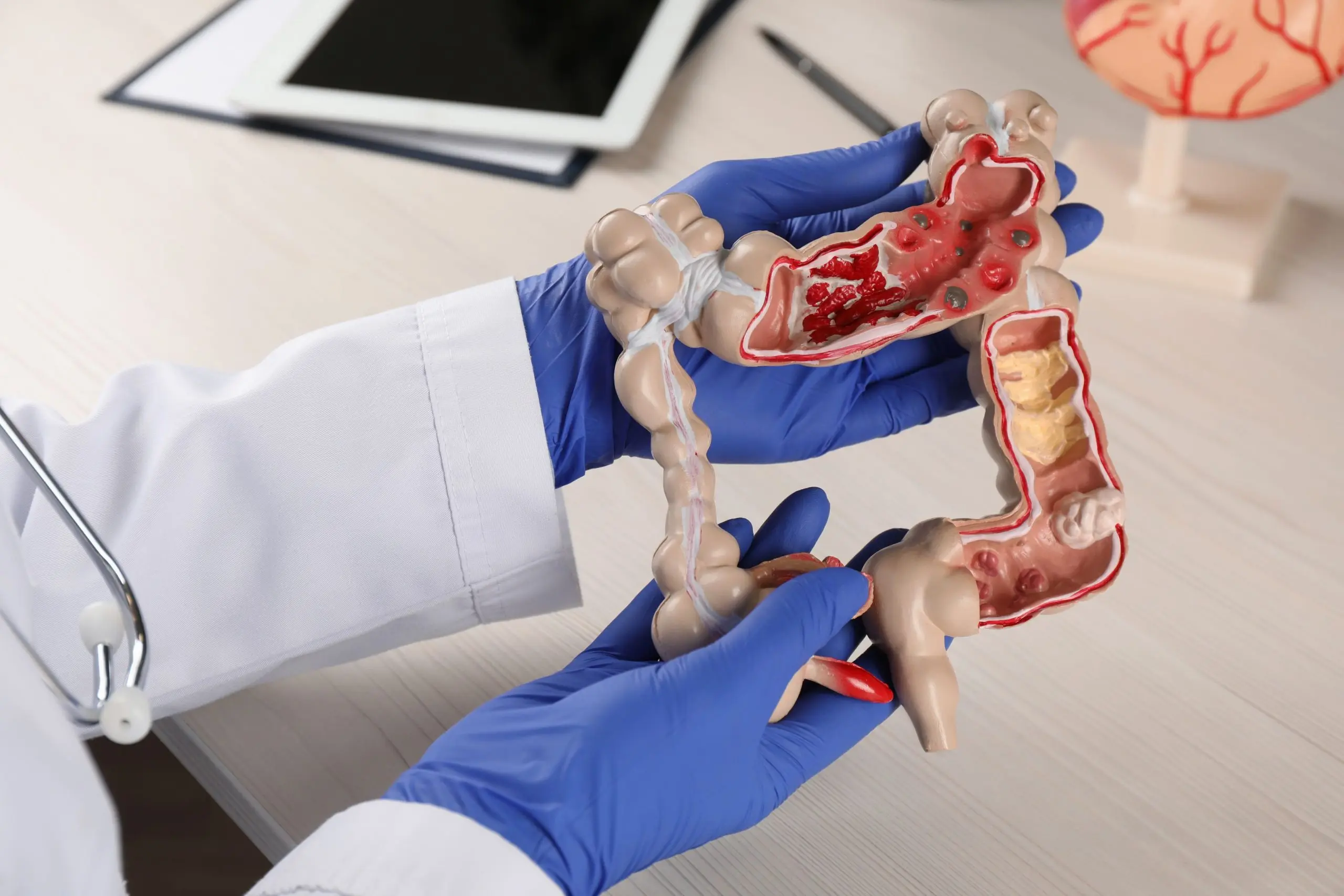 GI and colon surgery banner graphic