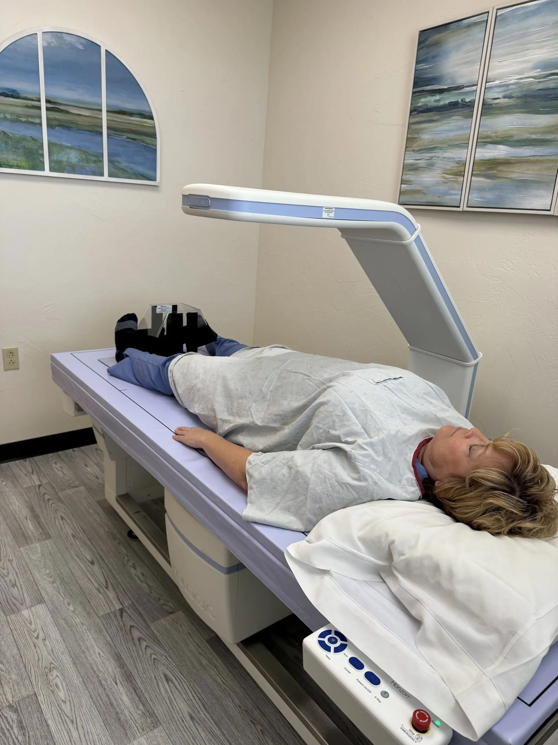 DXA scan with TBS for bone health