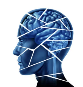 Brain injury and neurological Image