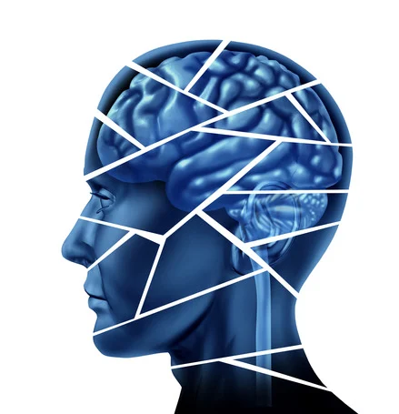 What Are Some of the Most Common Causes of Traumatic Brain Injuries?