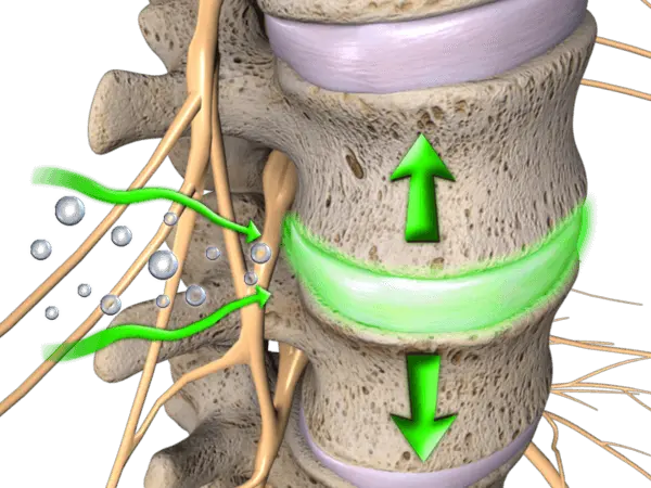 Spine diagram with arrows indicating movement.