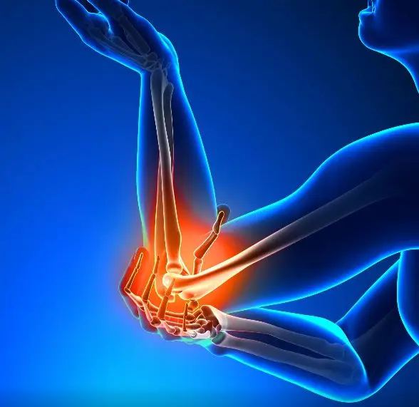 Elbow Pain - Dynamic Health Carolinas Graphic of person with pain in the elbow