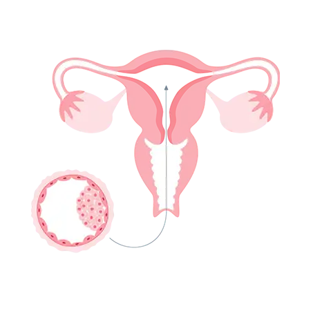 embryo-transfer