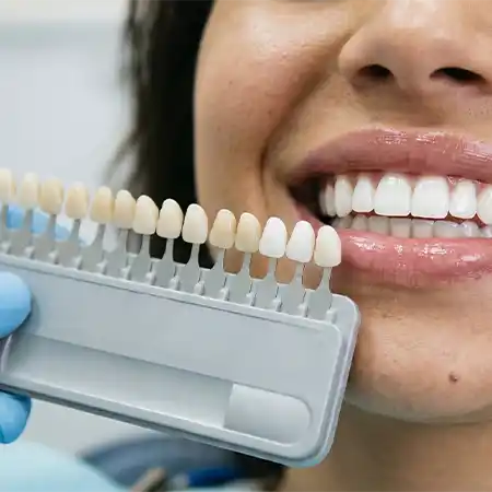 Dr. Chris Cerasaro begins whitening treatments by evaluating your current tooth color, the condition of your enamel and gums, and any crowns, veneers, bonding, or tooth-colored fillings that may affect the final result.