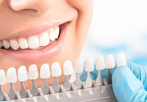 Professional teeth whitening can help brighten your smile.