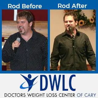 Rod Before After2