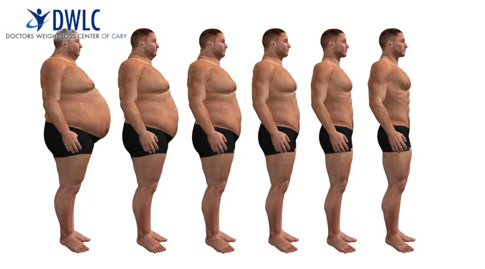Obesity, Immunity, and Viral Resilience: A Medical Perspective for Cary Residents