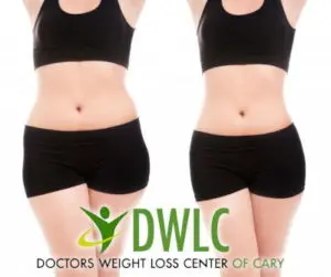 before-after-diet 1