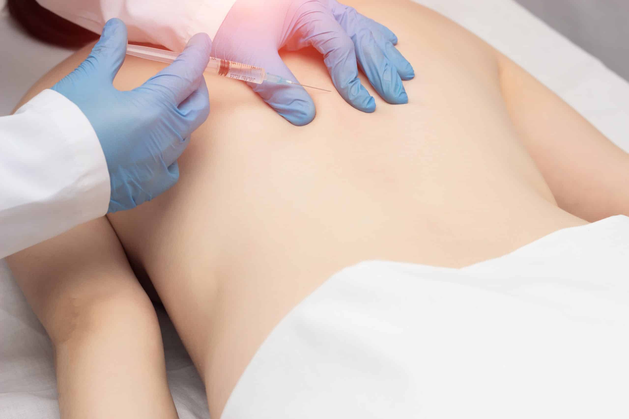 Stem Cells Vs PRP Stem Cell or PRP injection into the Back