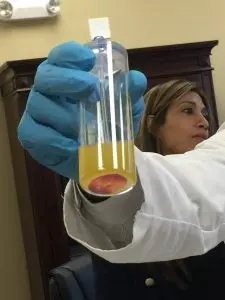 stem-cell-for-back-pain
