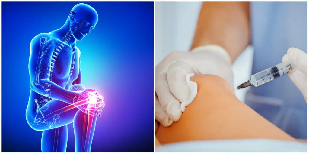 stem-cell-therapy-or-surgry-for-knee-pain