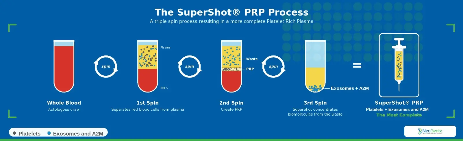 The SuperShot PRP process: a triple-spin process that adds exosomes and A2M for a more complete platelet-rich plasma