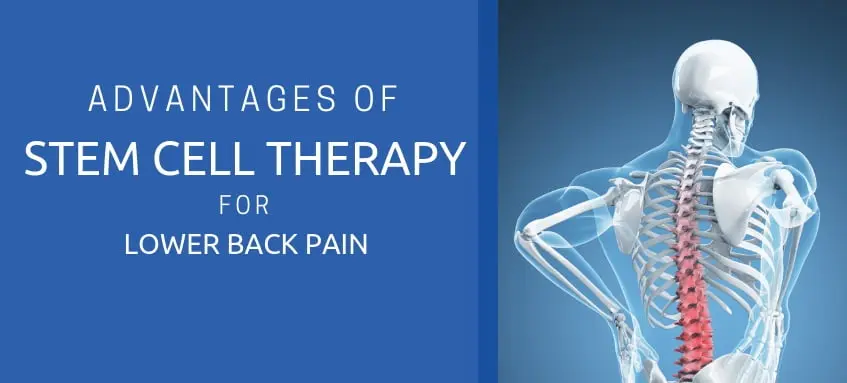 The advantages of stem cell therapy for lower back pain. stem-cell-therapy-for-lower-back-pain