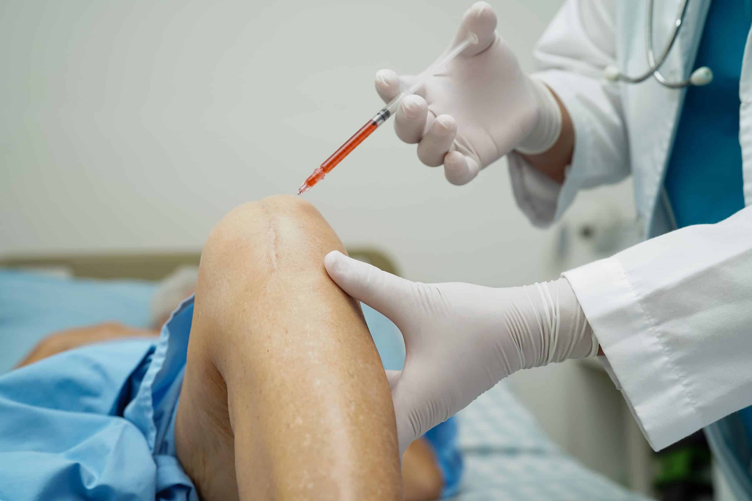 The Importance of Choosing the right PRP Provider