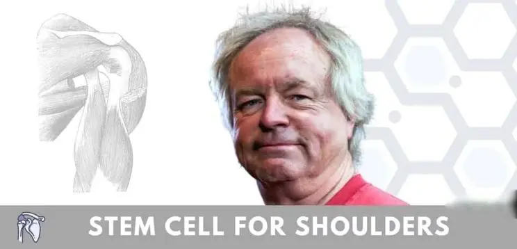 Stem Cell Injections for Shoulder Arthritis