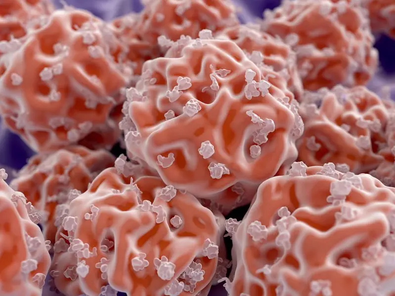 Stem Cell Therapy for Degenerative Disc Disease 2 Stem-Cell-Therapy-for-Degenerative-Disc-Disease
