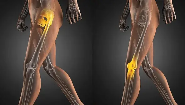 Common causes of Hip and Knee pain