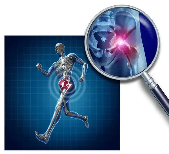 joint-replacement joint replacement