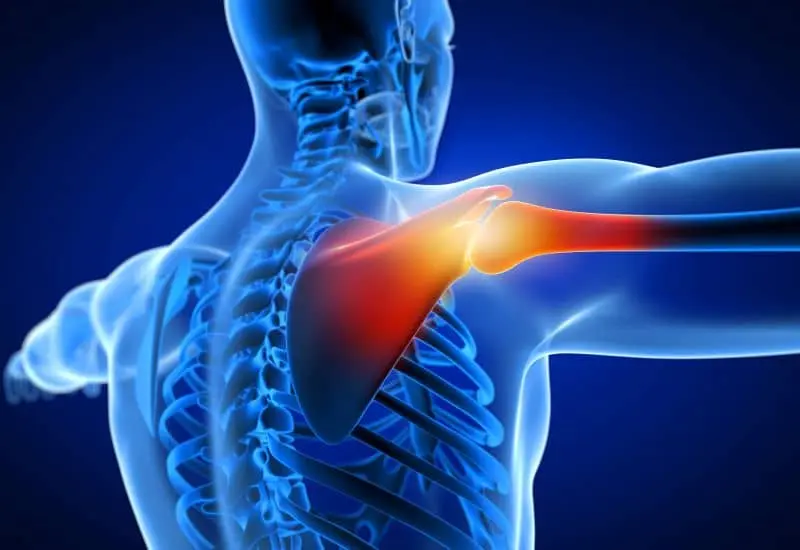 Carolina Regional Orthopaedics shoulder replacement Carolina Regional Orthopaedics shoulder replacement