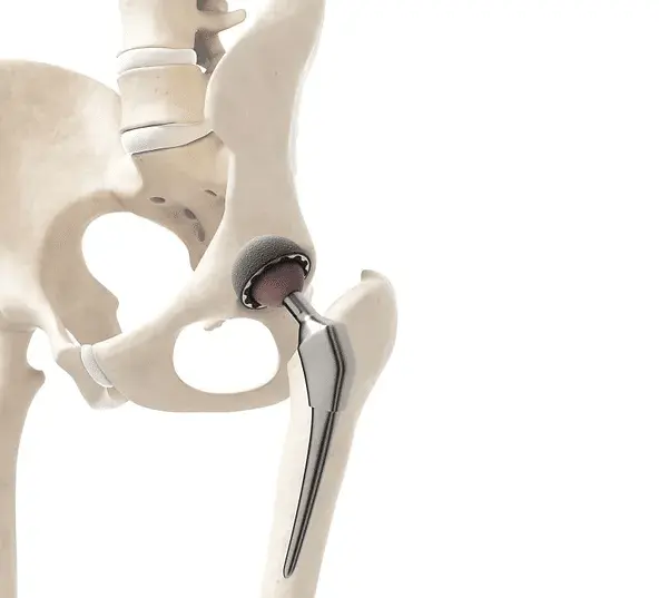 hip-joint hip joint