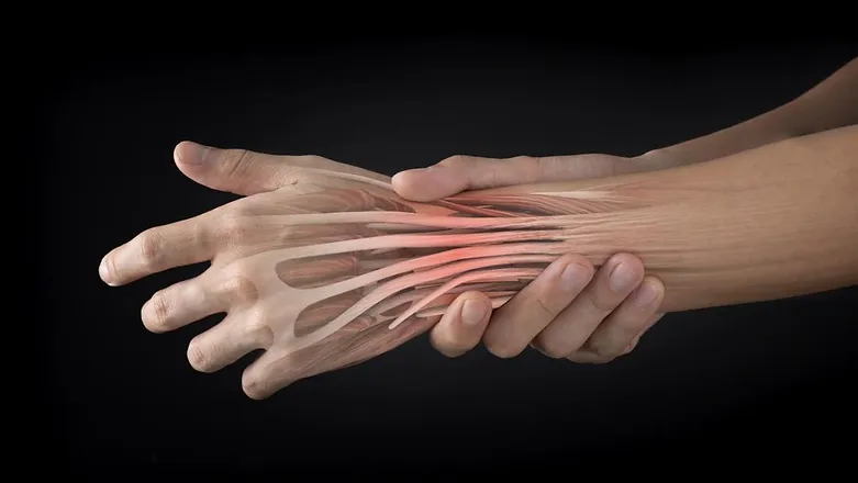 De Quervain’s Disease