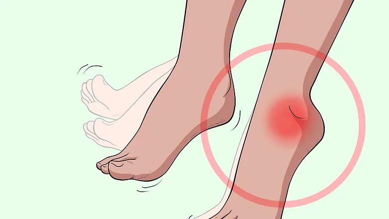 Foot Drop