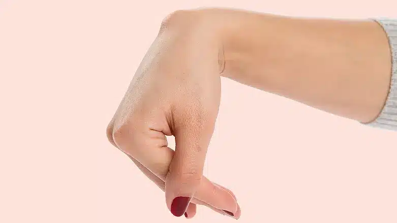 Ganglion Cyst