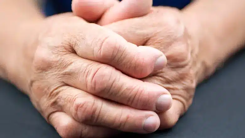 Thumb Arthritis