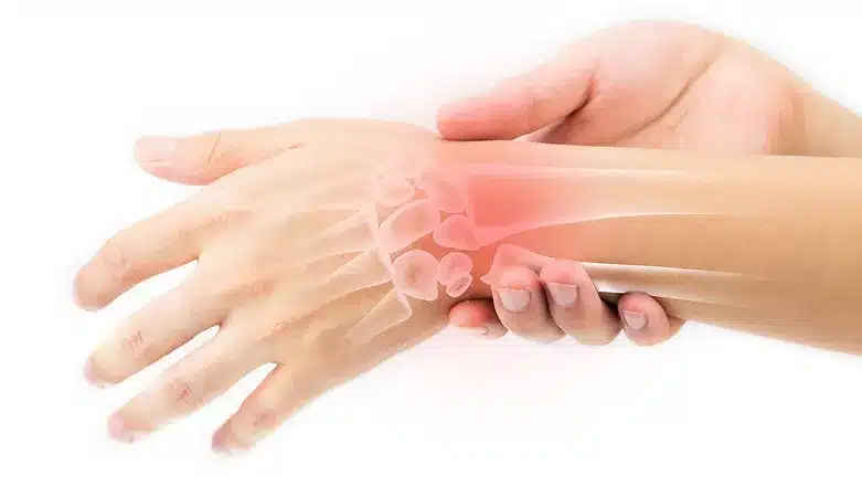 Wrist Fracture