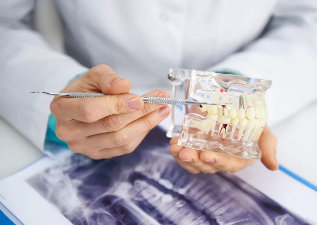 Dental implants research dentist