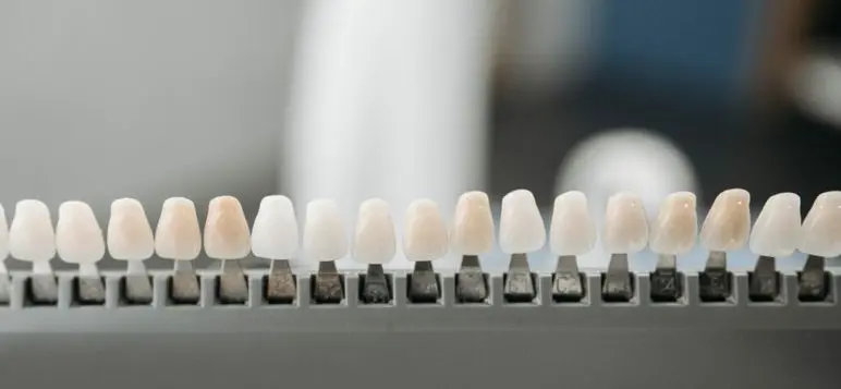 veneers for crooked teeth image