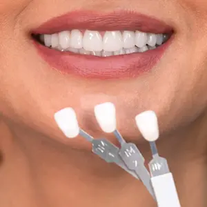 veneers1