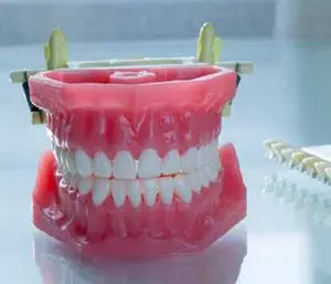 chicago dentures teeth b 300x257 1