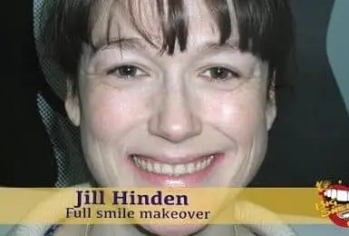 video placeholder jill