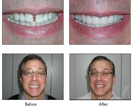 tom modal