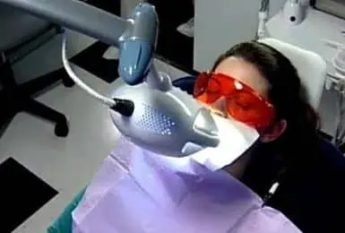 video placeholder whitening work